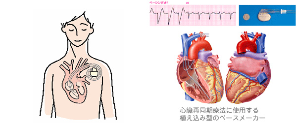 ph_disease05
